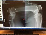 Knee